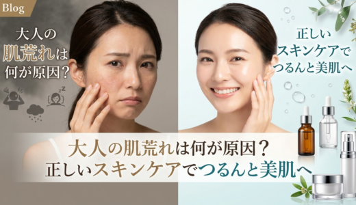 大人の肌荒れは何が原因？正しいスキンケアでつるんと美肌へ