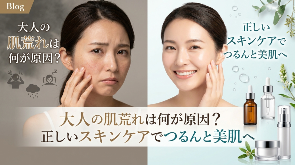 大人の肌荒れは何が原因？正しいスキンケアでつるんと美肌へ