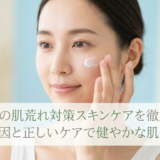 敏感肌の肌荒れ対策スキンケアを徹底解説。原因と正しいケアで健やかな肌へ。